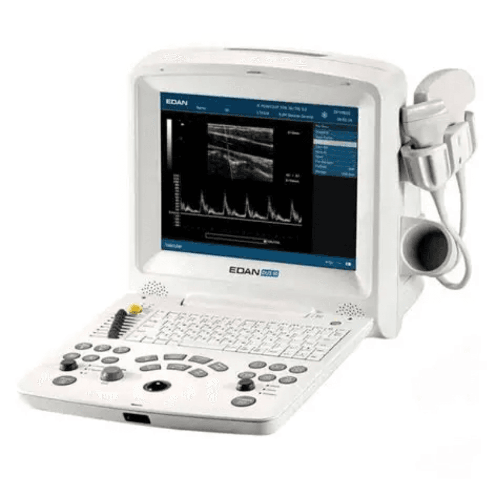 Image de ECHOGRAPHE DUS 60 - EDAN